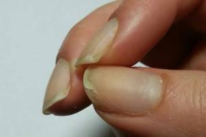 Как сделать ногти красивыми и ухоженными