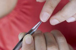 How to remove a splinter from under a nail: procedure, tools and recipes
