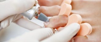 Pedicure at home: photos step by step for beginners, designs