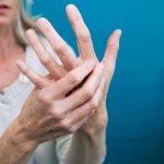 Синие ногти на руках. Причины у женщин, мужчин, как лечить при беременности