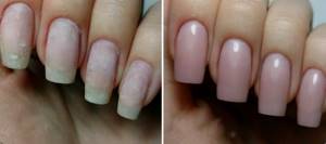 Укрепление ногтей акрилом, фото до и после